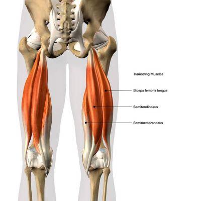 Tendinitis proximal del tendón de la corva: cómo evitar esta lesión común del yoga